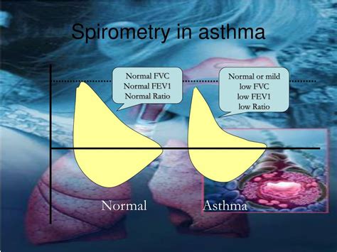 PPT - Asthma For a better control PowerPoint Presentation, free ...
