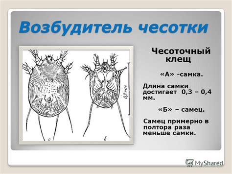Презентация на тему: "Чесотка. Профилактика. ВОЗБУДИТЕЛИ ЧЕСОТКИ ...