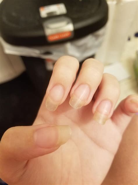 Why Do My Nails Turn Clear After Shower at Glenn Thacker blog