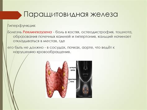 Эндокринные нарушения - презентация онлайн