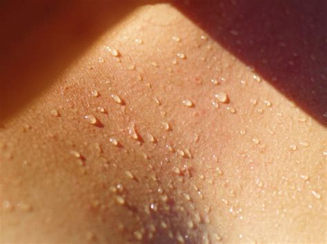 Sweat: the good, the bad and the sticky | BCM