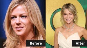 Kaitlin Olson Botox And Face Lift: Before And After Photos