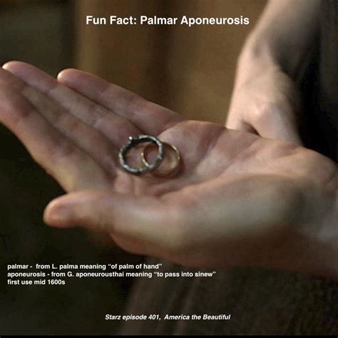 Fun Fact: Palmar Aponeurosis – Outlander Anatomy