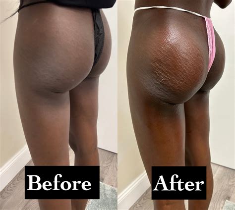 Tier 3 BBL – Body Shop Orlando