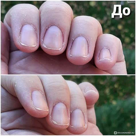 Средство для удаления кутикулы Essence Cuticle Remover Eraser Quick ...