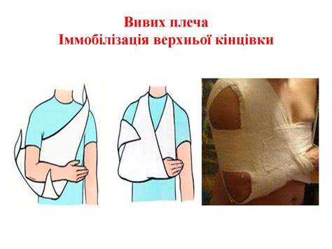 Догляд за хворими з хірургічними захворюваннями і ушкодженнями кінцівок ...