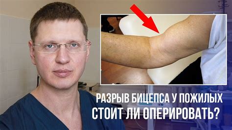 Разрыв бицепса у пожилых, стоит ли оперировать? - YouTube