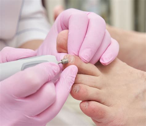 Медицинский педикюр | Bonne Clinique