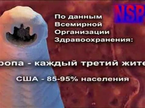 Фильм паразиты в организме человека - Признаки паразитов в человеке ...