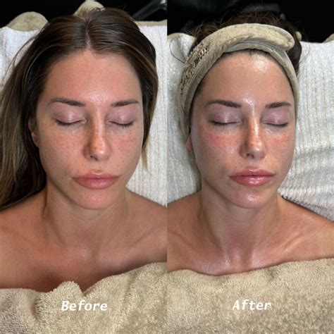 Biologique Recherche Facials in Colubmus, OH | MediZen Institue
