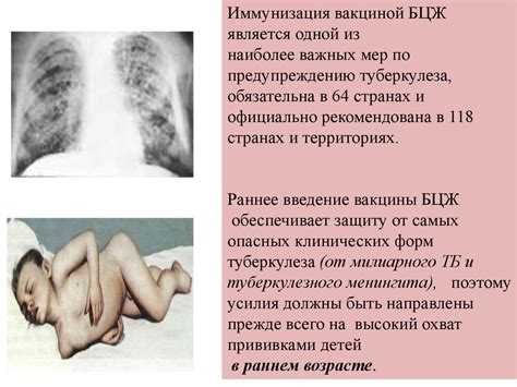 Профилактика туберкулеза. Вакцинация БЦЖ - презентация онлайн