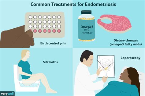 How Endometriosis Is Treated