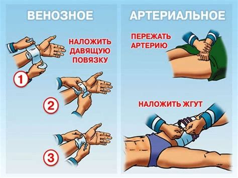 Відкритий перелом: ознаки, класифікація та лікування