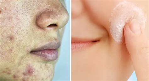 Лучшие скрабы для лица - чем следует отшелушивать кожу?