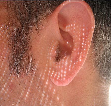 How to ease tinnitus | Constant Ringing Ears