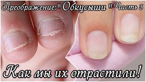 Преображение: "Обкусыши" 3. Они вам больше НЕ "ОБКУСЫШИ" ;) - YouTube