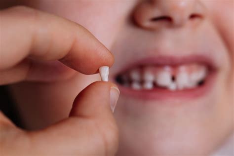 Baby teeth may help identify kids at risk for mental disorders ...
