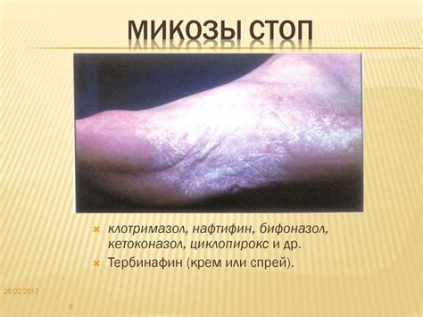 Современные противогрибковые средства - online presentation
