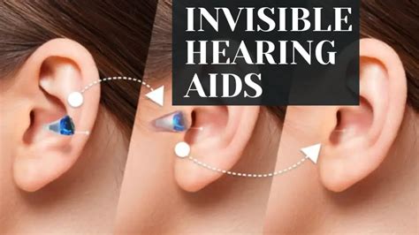 Invisible Hearing Aids: Empower Your Hearing