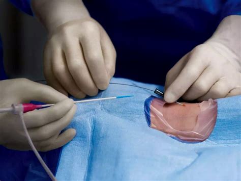 angioplasty hariharan diabetes heart care hospitals p