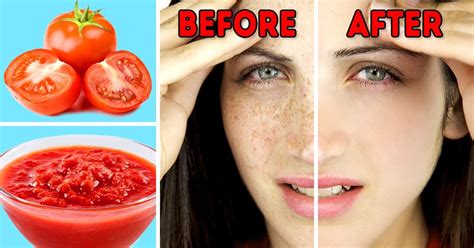 16 Tips for Removing Dark Spots From Sun on Face / Bright Side