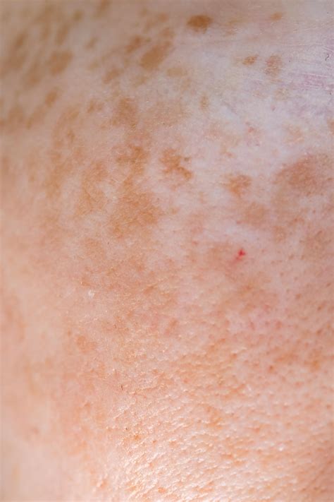 Types Of Melanin Skin Photos, Download The BEST Free Types Of Melanin ...