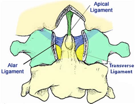 Atlas Fractures & Transverse Ligament Injuries - Spine - Orthobullets