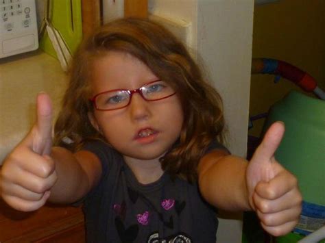 Many Faces of Moebius Syndrome - Emma. Moebius Syndrome is a rare ...