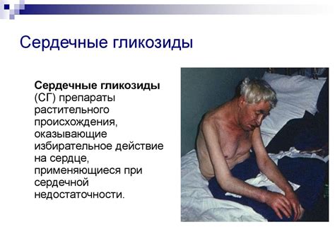Сердечные гликозиды - презентация онлайн