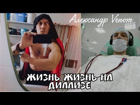 Жизнь на диализе - YouTube