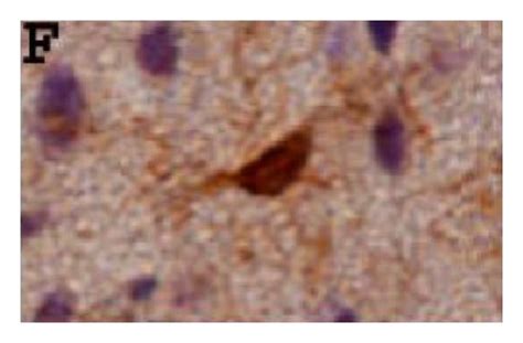 comparative morphology  activated amoeboid microglia  resting