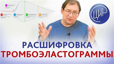 Расшифровка тромбоэластограммы. Значение тромбоэластограммы при ...