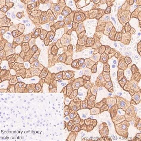 Anti-pan cytokeratin antibody [EPR28285-45] (ab308262) | Abcam