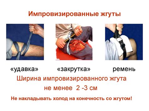 Первая помощь при кровотечении и травматическом шоке - презентация онлайн