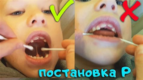 ПОСТАНОВКА ЗВУКА Р ЗА 1 МИНУТУ. Логопед для вас - YouTube