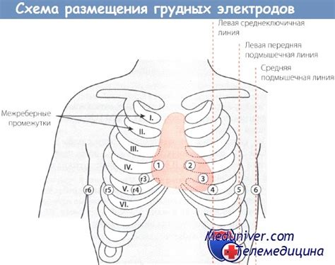 Грудные отведения ЭКГ - наложение электродов, оценка