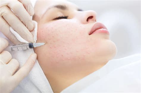Мезотерапия - все о процедуре 💗 PROFESSIONALS BEAUTY