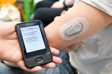 Dexcom G6 Sensor Numbers
