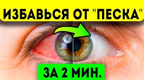 Pin on Health-Здоровье