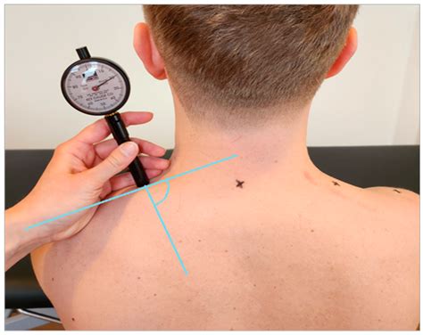 Examination of Myofascial Stiffness and Elasticity in the Upper