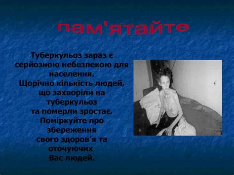 Туберкульоз. Збудник туберкульозу - презентация онлайн