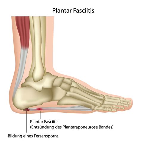 plantar fasciitis ankle sleeve – neosportslab.com