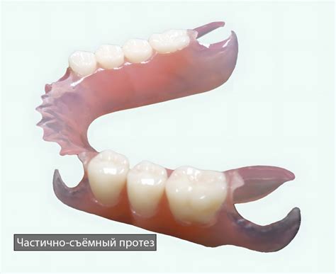 Ортопедическая стоматология | Врач стоматолог ортопед: чем занимается