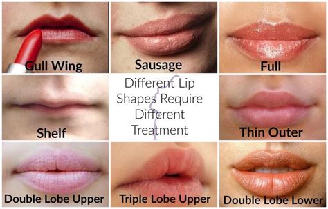 Types of Lips | Shape of Lips | Cosmetic Injectables