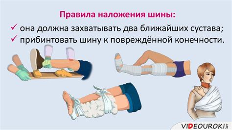 Первая помощь при ушибах, растяжениях, вывихах и переломах ...