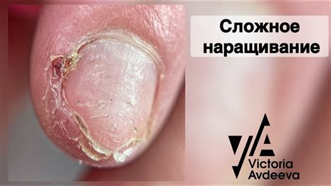 СЛОЖНОЕ НАРАЩИВАНИЕ НОГТЕЙ. МАНИКЮР. Виктория Авдеева - YouTube