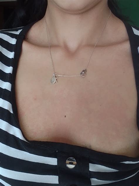 [Zodpovedané] Z čoho sa mi môžu vytvárať tieto fľaky na hrudi? - Modrý