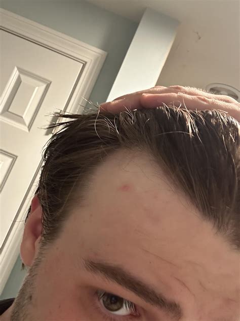 Is my hair thinning? : r/malehairadvice