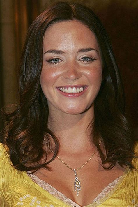 Emily Blunt Veneers