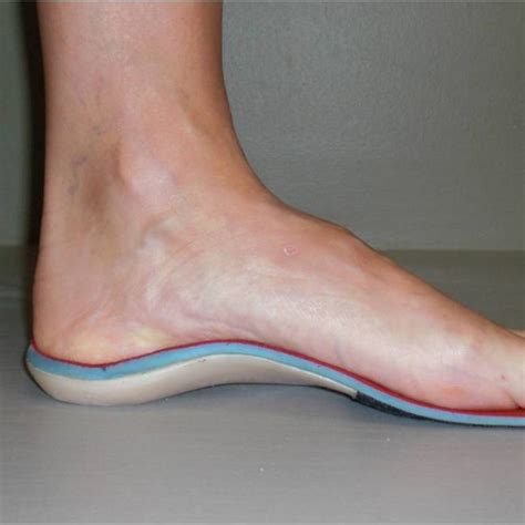 Custom Foot Orthotics - Westside Podiatry - Foot And Ankle Specialists